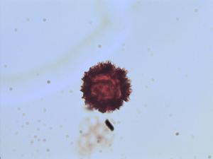 Hieracium abscissum pollen