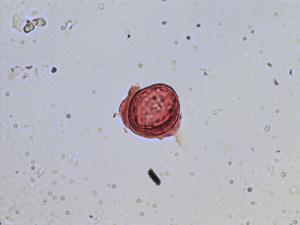 Saxifraga hypnoides pollen