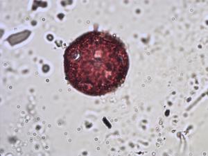 Cerastium uniflorum pollen