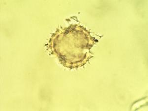 Chiliotrichum diffusum pollen