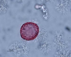 Ranunculus penicillatus pollen