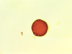 Pollen from the plant Genus Aidia.