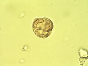 Hesperomeles lanuginosa pollen