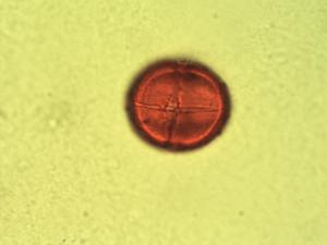 Pollen from the plant Genus Drypetes.