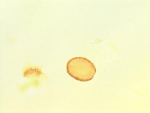 Pandanus candelabrum pollen