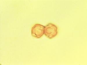 Bruguiera gymnorhiza pollen
