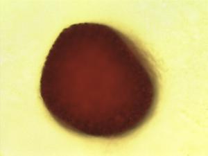 Pollen from the plant Genus Dicranolepis.