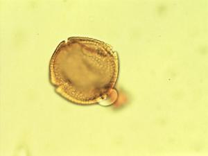 Pollen from the plant Genus Waltheria.
