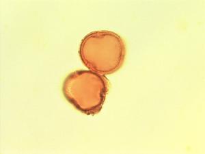 Pollen from the plant Genus Dillenia.