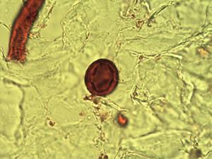 Cnestis ferruginea pollen