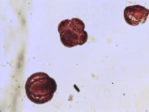 Blackstonia perfoliata pollen