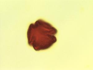 Pollen from the plant Genus Brexia.