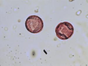 Ranunculus lanuginosus pollen