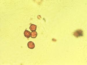 Pollen from the plant Genus Dorycnium.