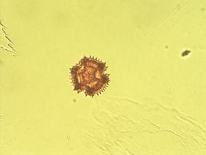 Sonchus acaulis pollen