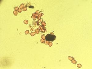 Echium leucophaeum pollen