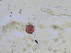 Cochlearia pollen
