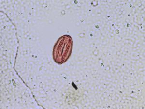 Sempervivum montanum pollen