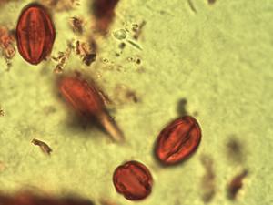 Pseudospondias microcarpa pollen