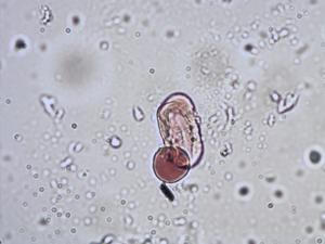 Selinum carvifolia pollen