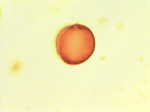 Triplochiton pollen