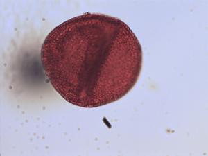 Asphodelus fistulosus pollen
