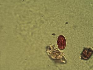 Cyclospermum leptophyllum pollen