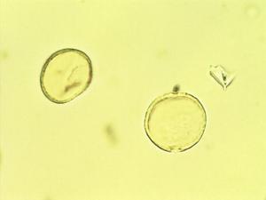 Trema micrantha pollen
