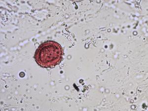 Aristolochia pollen