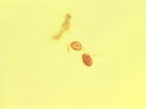 Anisophyllea boehmii pollen